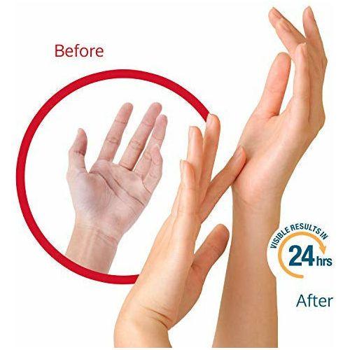 FLEXITOL Hand Balm for Dry and Itchy Skin - 56g | Relieves the Symptoms of Mild Dermatitis, Eczema and Psoriasis 1